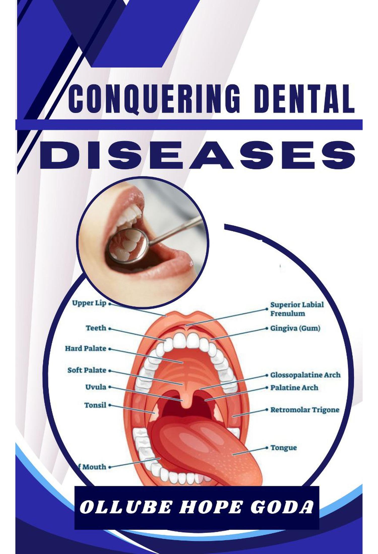 Conquering Dental Diseases